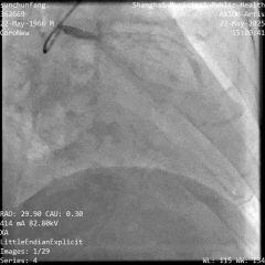 OCT Imaging 1