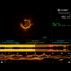 OCT Imaging 2