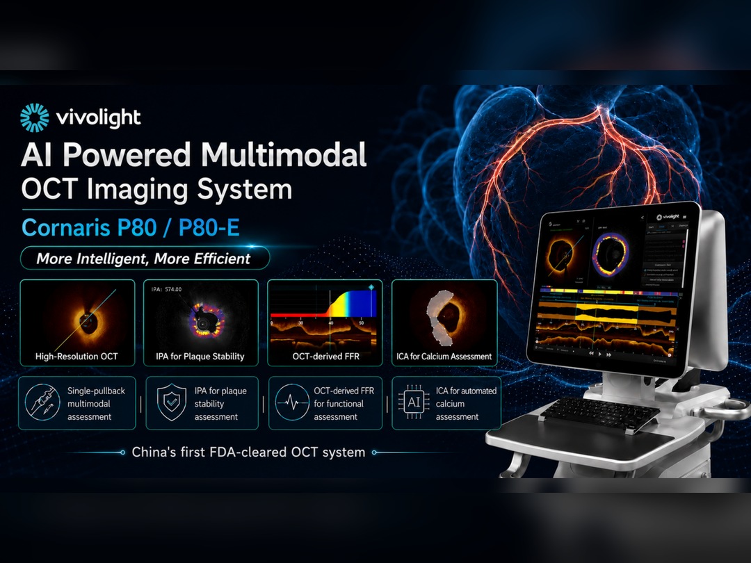 IVUS/OCT-Guided PCI: What 8 Large Randomized Trials Tell Us